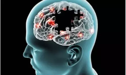 At-home blood tests show accurate detection of key Alzheimer’s biomarkers