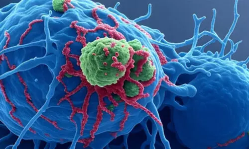 High intake of preservative-rich processed foods may raise cancer risk