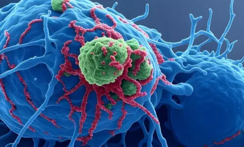 Study finds hyaluronic acid could aid gynaecological cancer treatment