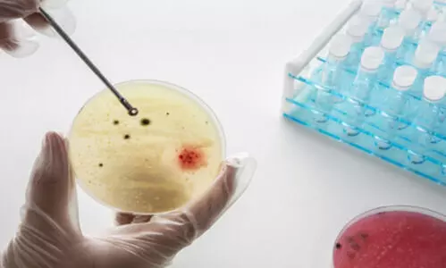 New indigenous antibody discovery platform set to transform diagnostics