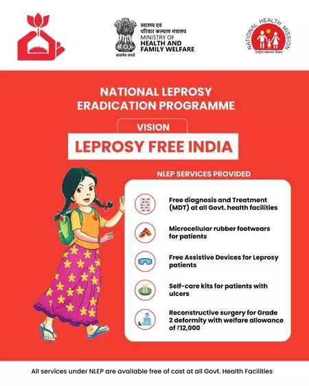 Govt says free diagnosis, treatment will help make India leprosy-free