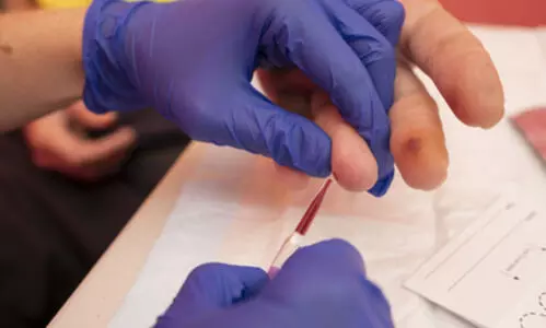 Hepatitis B diagnosis access to widen with world-first fingerstick test