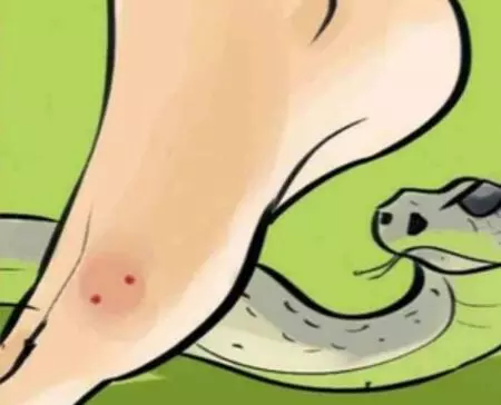 Gujarat to introduce anti-venom tailored to local snakes