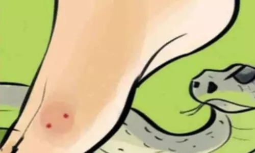 Gujarat to introduce anti-venom tailored to local snakes