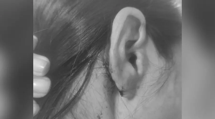 Four minors held for assault on Manipur woman near Delhis Saket Court Four minors held for assault on Manipur woman near Delhis Saket Court