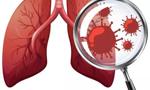 Sri Lanka records nearly 9,500 tuberculosis cases annually